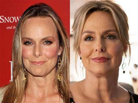 melora hardin boobs|Melora Hardin Plastic Surgery Comparison Photos